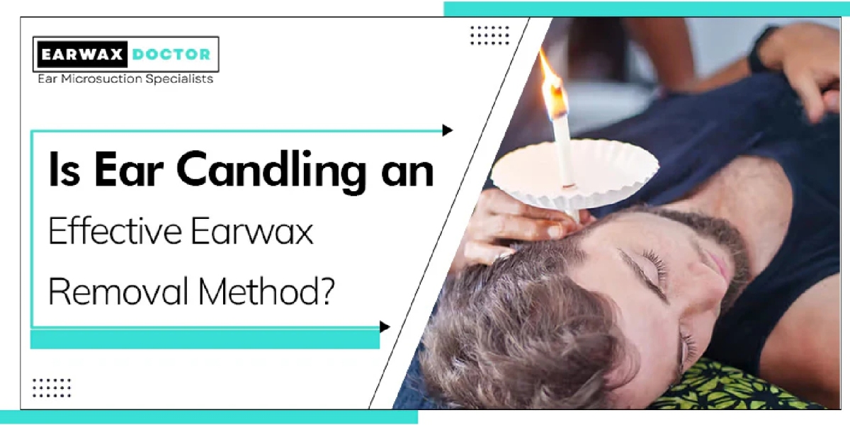 Ear Candling: An Effective Way to Remove Earwax